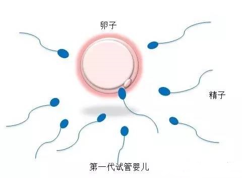 正规供卵代生子